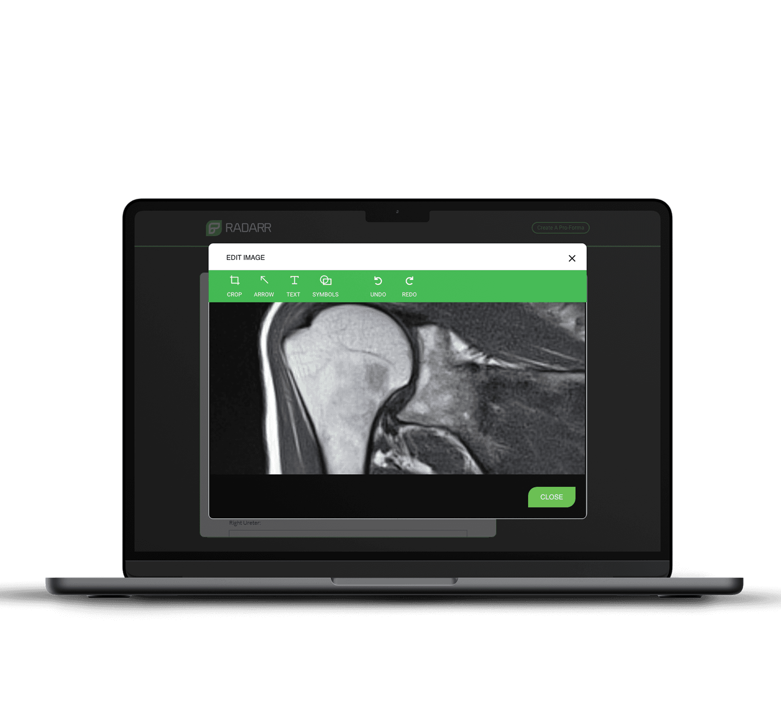 Radarr programme on macbook